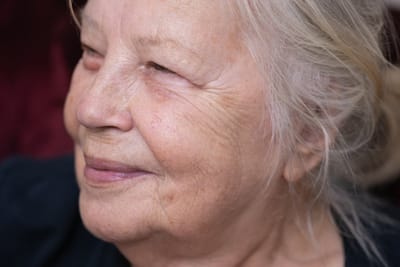 Этот знак на вашем лице может указать на риск развития деменции