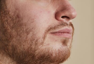 Можно ли удалять волосы в носу? Что говорят врачи