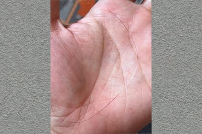 Волосы показали следы пережитого стресса: вирусное фото