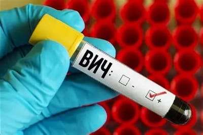 923 новых случая ВИЧ выявили в Беларуси с января по октябрь. В каком регионе показатели выше всего