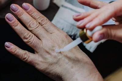 Домашний бальзам от пигментных пятен: уже после первого применения заметен результат