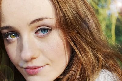 Глаза разного цвета — дар природы или тревожный сигнал?