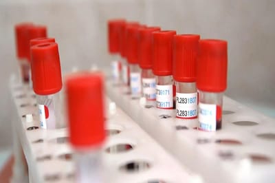 Минздрав уточнил правила внесения группы крови в паспорт: что важно знать