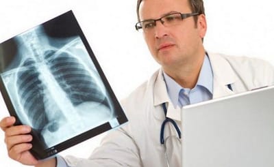 Пневмония после 60 лет: скрытые симптомы и высокий риск осложнений