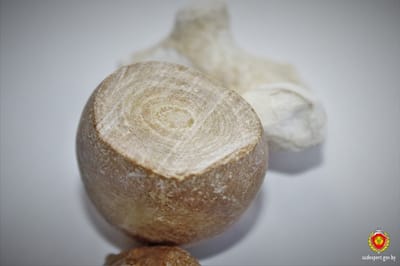 Почечный камень внушительных размеров извлекли у жителя Гродно