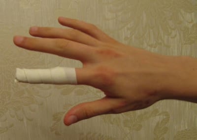 Родители купили сыну пневматический пистолет, а он прострелил себе палец