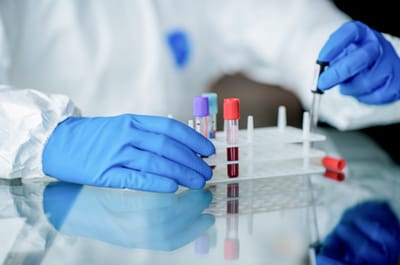 Случайный тест спас мужчину от смертельной болезни