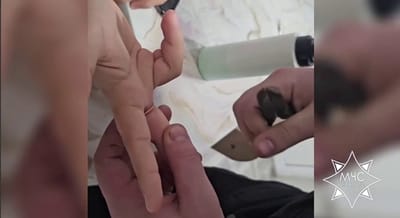 Спасатели помогли подростку снять застрявшее кольцо