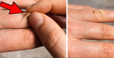 Узнайте за 2 секунды, обезвожен ли ваш организм и нужно ли вам пить больше воды