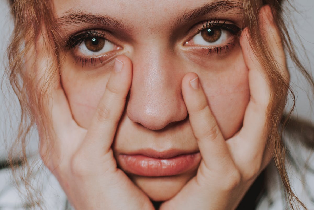 Откуда берутся темные круги под глазами и что они означают?  