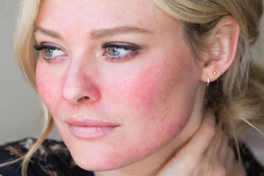 Четыре изменения цвета кожи, которые предупреждают о болезнях