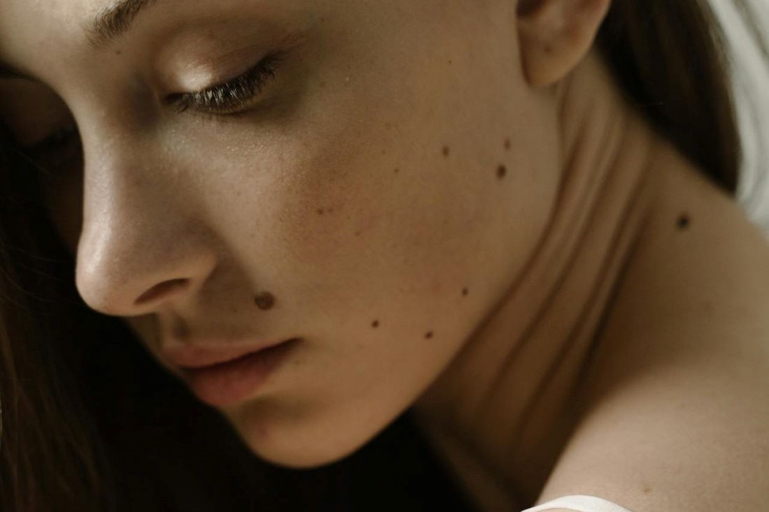 Если у вас есть родинка в этом месте, вам повезло: богатство и благополучие с вами на всю жизнь