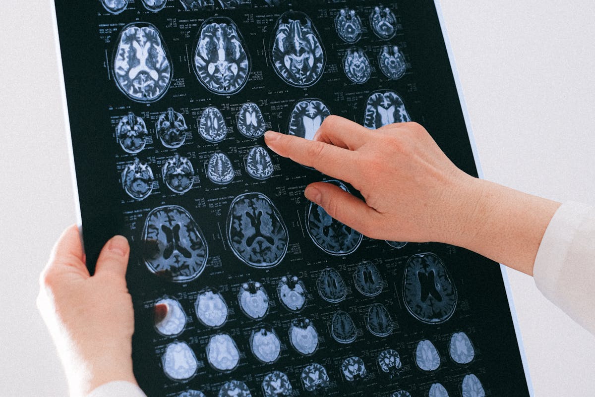 Наш мозг меняется четыре раза за жизнь: во сколько лет происходят главные трансформации?