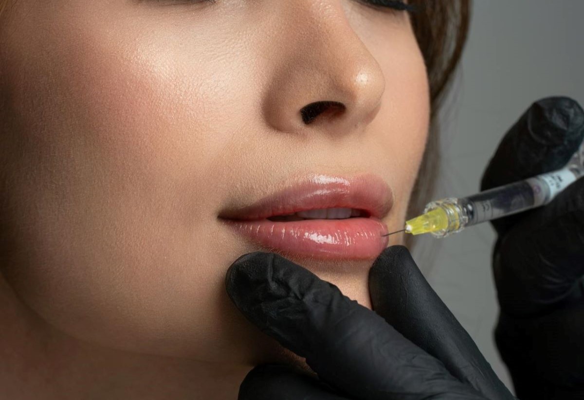 УЗИ помогло выявить опасные последствия инъекций филлеров