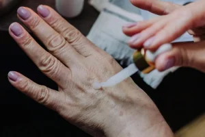 Домашний бальзам от пигментных пятен: уже после первого применения заметен результат